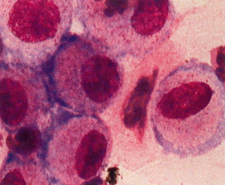 NCI-H596(人肺腺鳞癌细胞)图片
