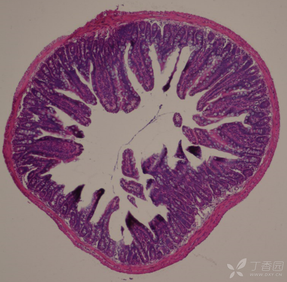 回肠切片手绘图图片