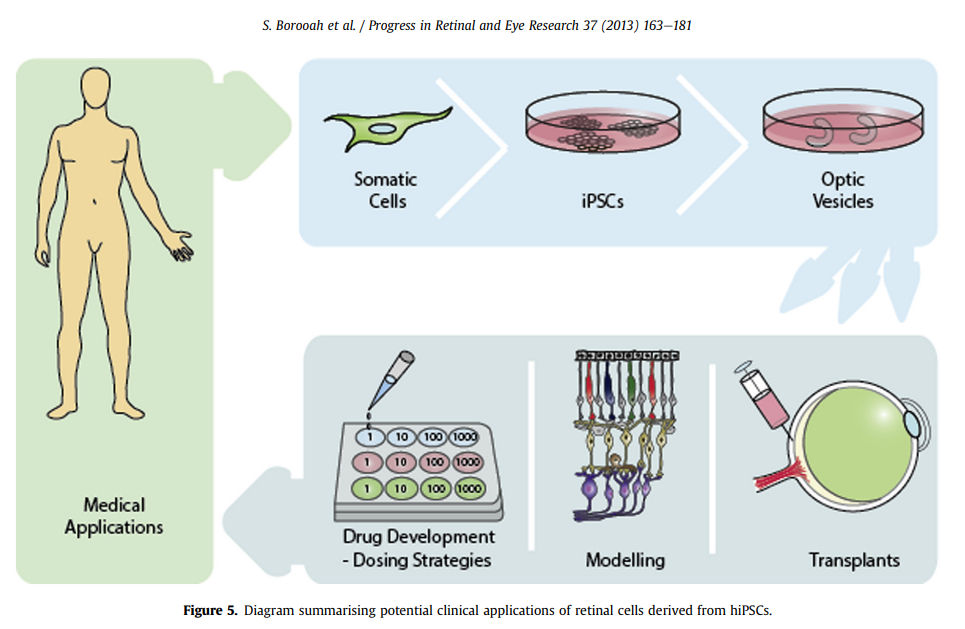 眼科权威专家介绍 iPSC 在眼科权威中的应用 