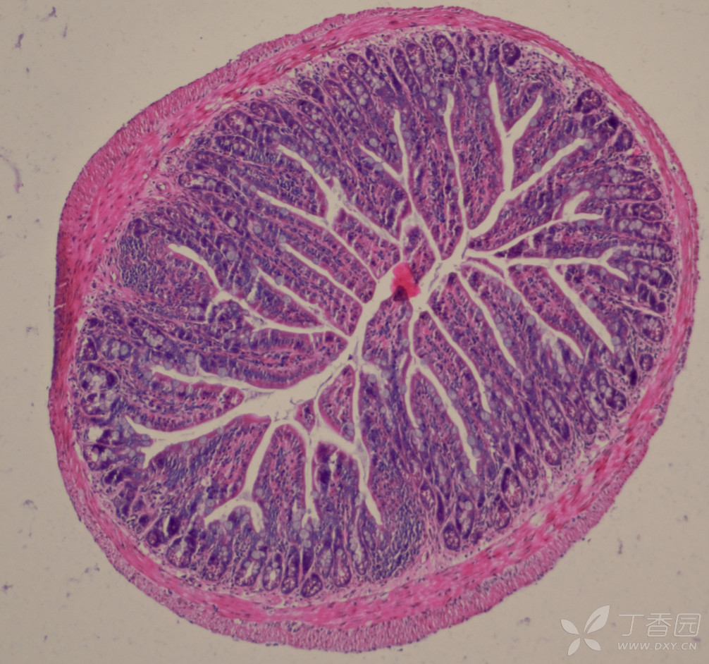 【求助】求大神帮忙,小鼠回肠段he染色的病理学分析