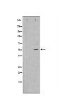 IL-6R Antibody