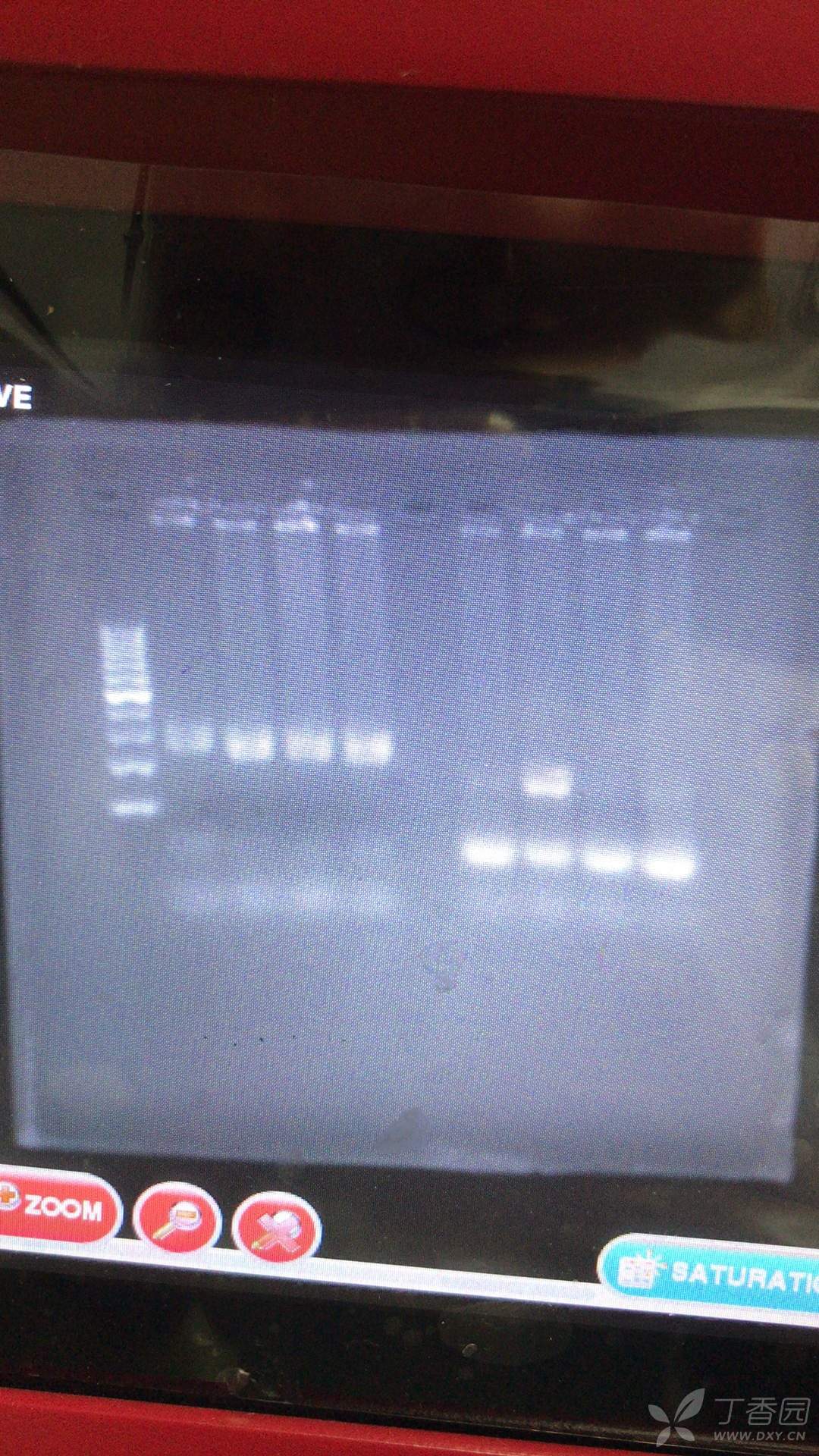 瓊脂糖凝膠電泳的條帶不清楚 - pcr技術討論版 - 專業醫生社區,醫學