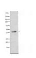 LMTK3 Antibody