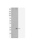 LCN2 Antibody