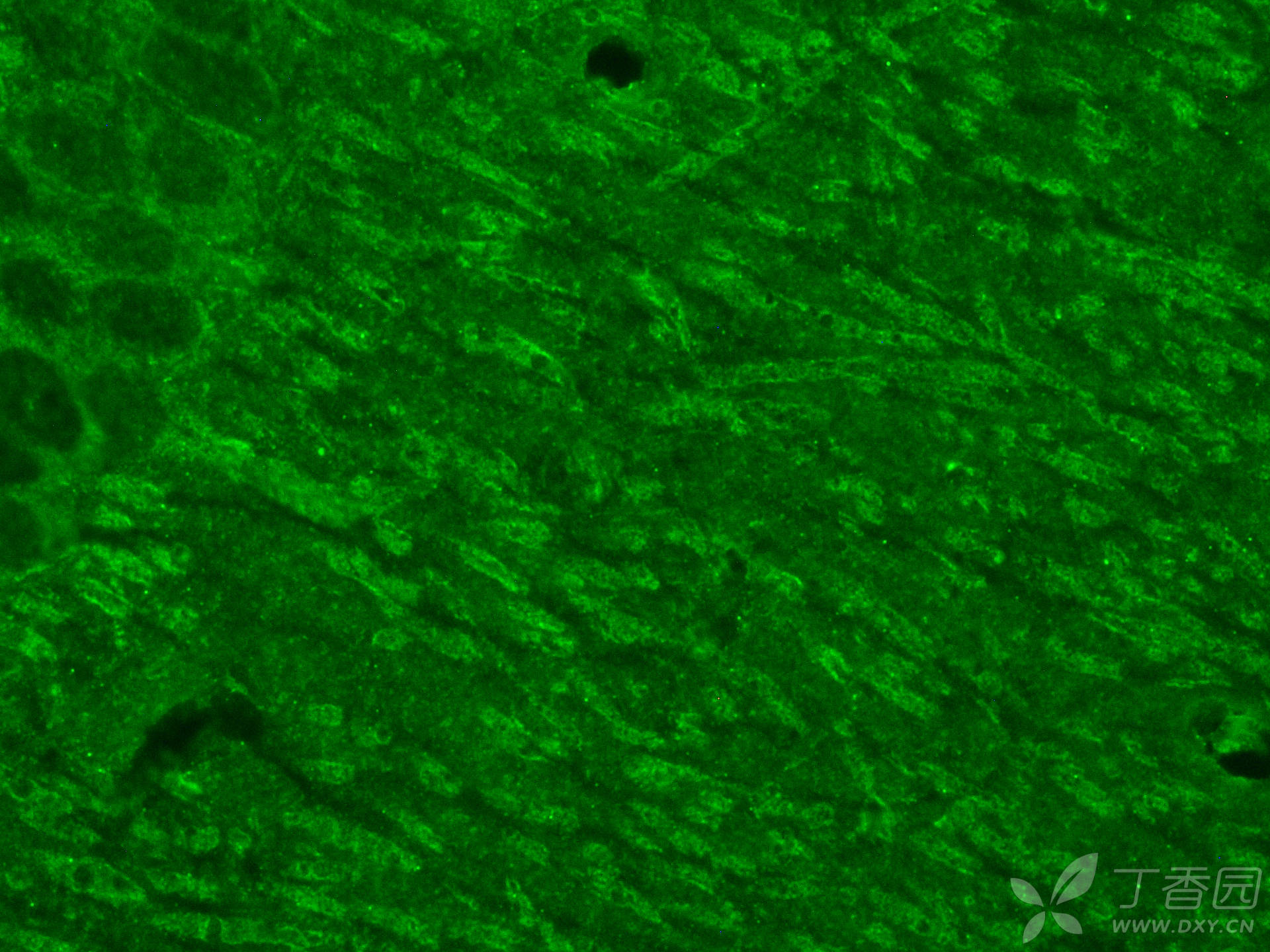 请问有没有tunel dcx荧光双染?万分感谢