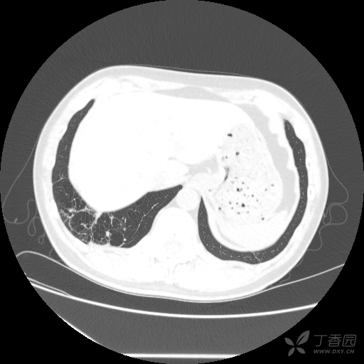 人有几个肺叶 3302674604782879024-8w.jpg