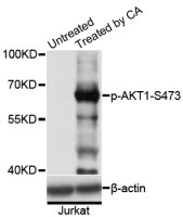 Anti-Phospho-AKT1-S473 pAb