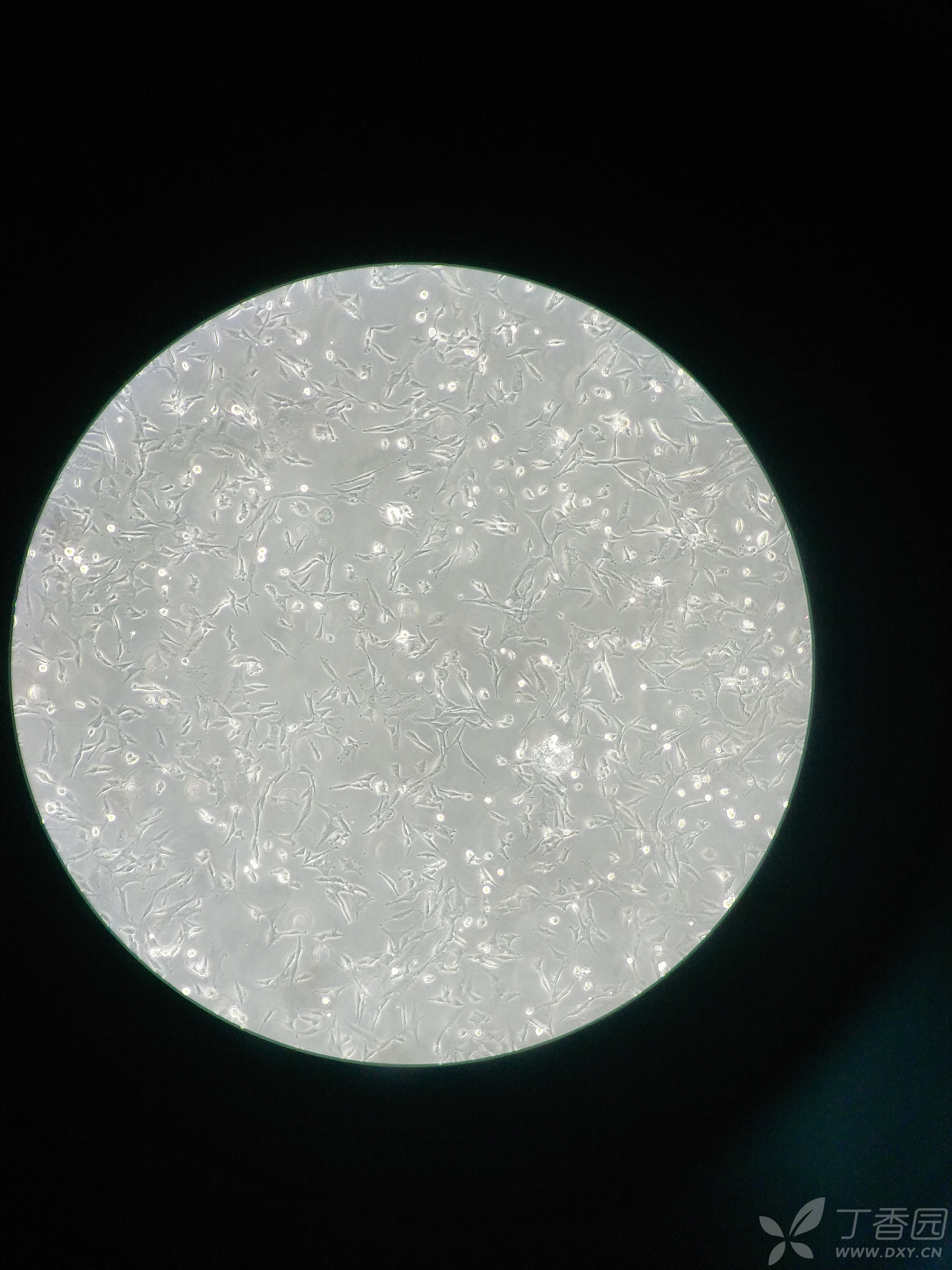 之前养df-1细胞,细胞题壁但是不长,时间长了就慢慢飘起来了,取培养液