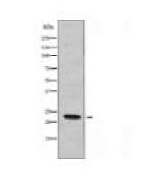 MYL6 Antibody
