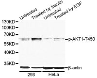 Anti-Phospho-AKT1-T450 pAb