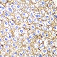CDH2