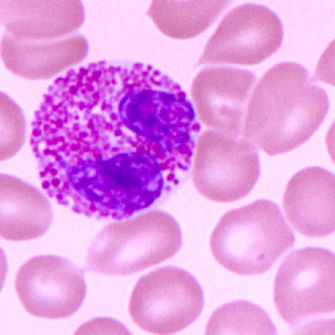 人卵巢癌细胞；ES-2图片