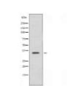 OR52A1 Antibody