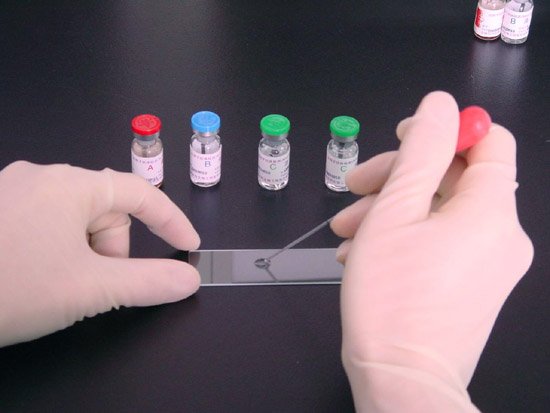 牛胆固醇(CH)ELISA试剂盒 