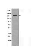 PNPLA6 Antibody