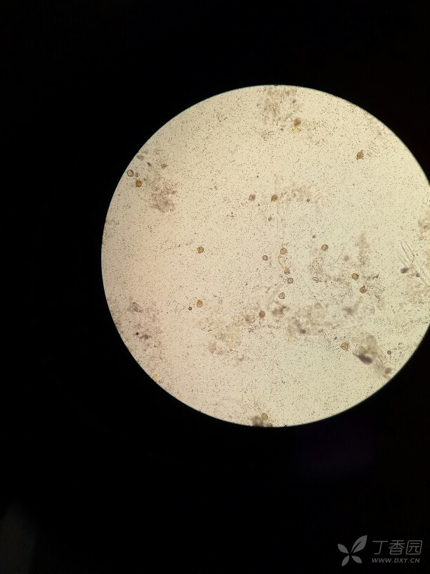 这是粪便里的食物残渣?