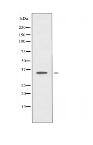 PDLIM1 Antibody
