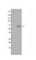 PHF1 Antibody