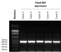 MDH-302 骨髓样本固定及脱钙试剂盒 （高级版）（A/B）