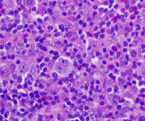 MDH-101 活检样本固定试剂盒(AZF法)