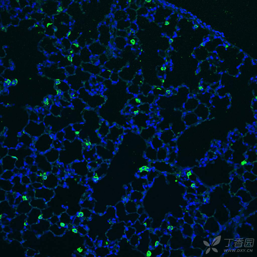 GFP抗体染色 小鼠肺 石蜡切片包埋 - 丁香园论坛