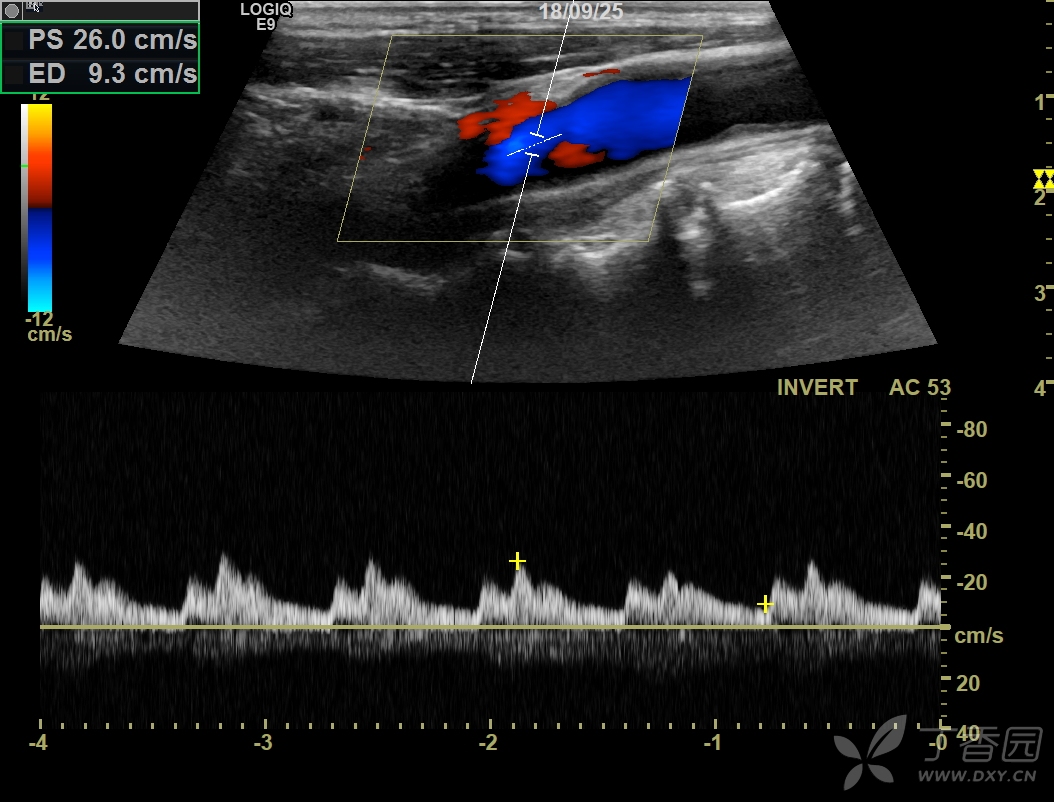 这种频谱图怎么这样啊!