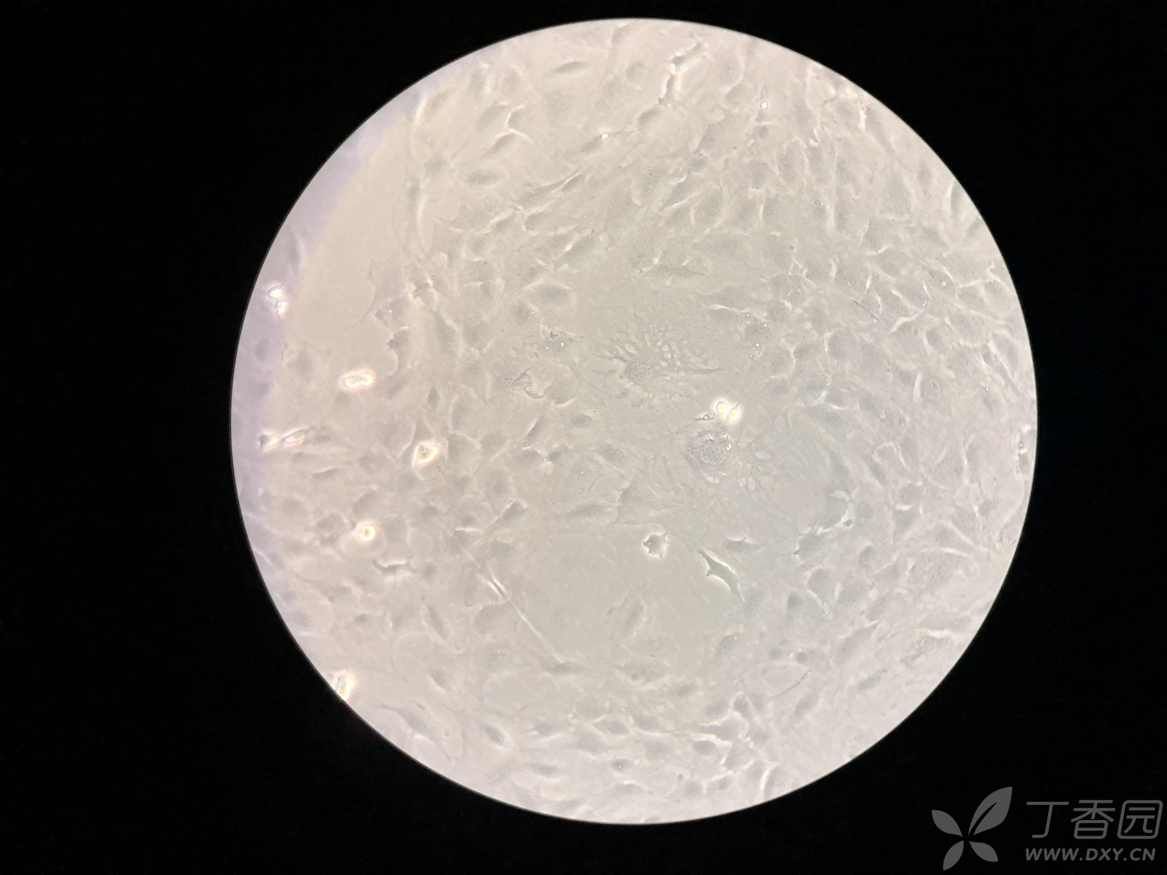 不太明白这是自然分化成成骨细胞了还是行成了破骨细胞?