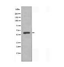PRLHR Antibody