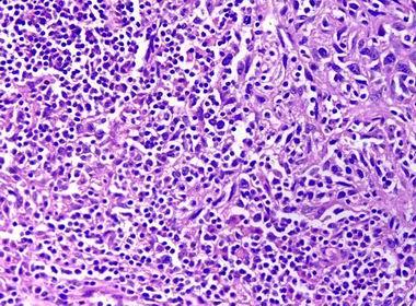 P3X63-Ag8.653;鼠骨髓瘤细胞