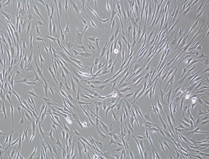 人羊膜间充质干细胞