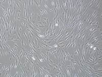 人羊膜间充质干细胞