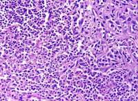 HBL-100;乳腺细胞