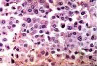淋巴细胞系统Lymphatic Cell System