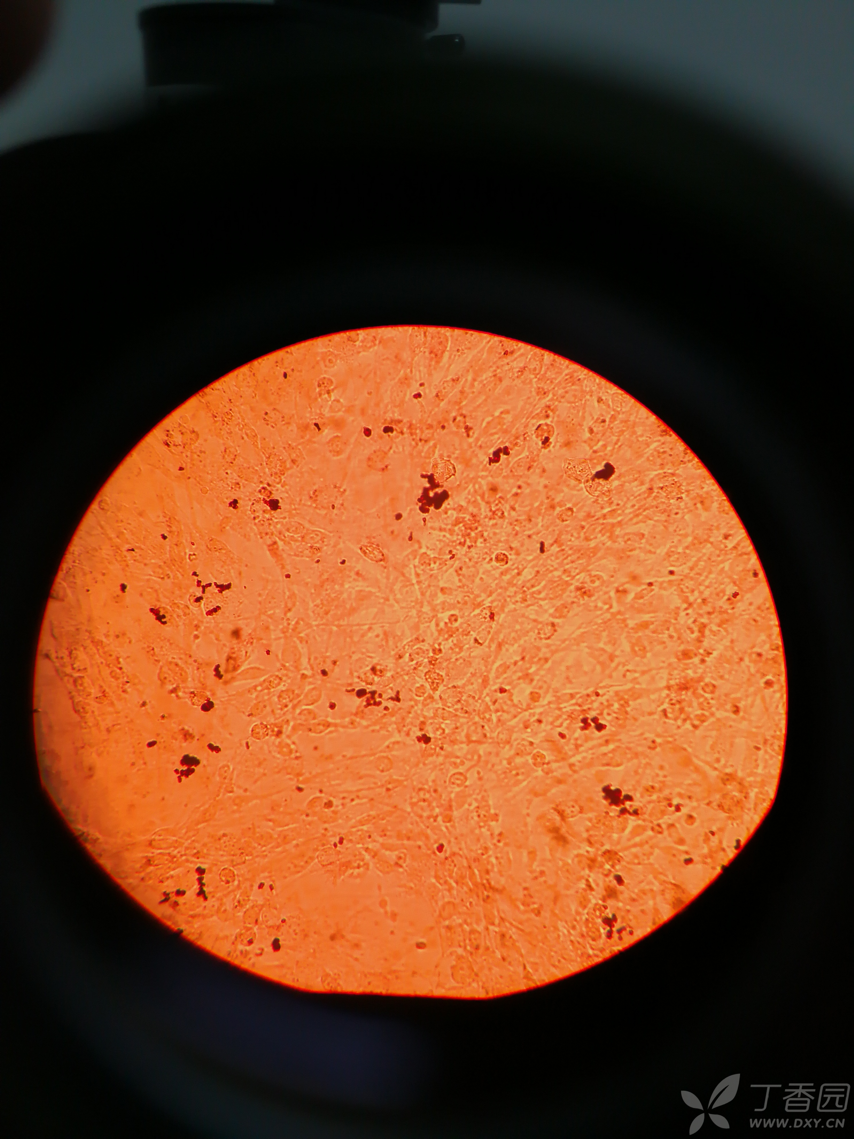 橘皮油细胞显微图图片