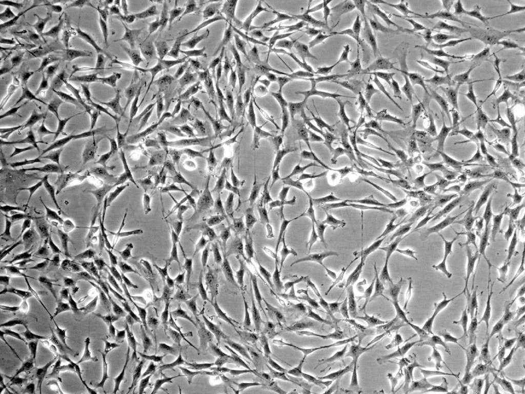 人胚肾细胞_AD293