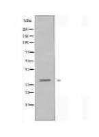 RNF138 Antibody