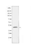 RPL5 Antibody