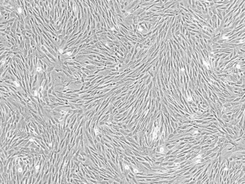 人乳腺癌细胞_MX-1