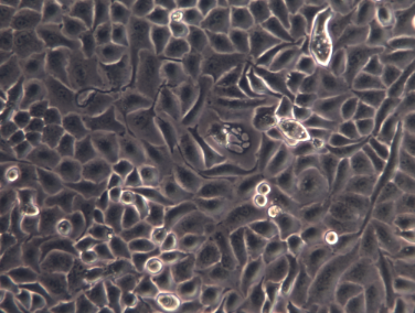 MCF-7B人乳腺癌细胞