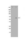 SLC22A5 Antibody