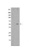 SLC16A1 Antibody