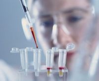 尿素转运型糖蛋白A2抗体图片