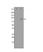 STAT5B Antibody