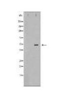 SMARCE1 Antibody