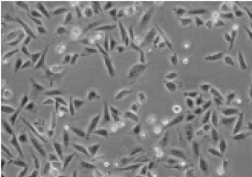 大鼠胰岛素细胞_INS-1