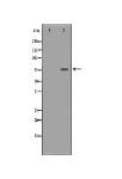 TMPO Antibody