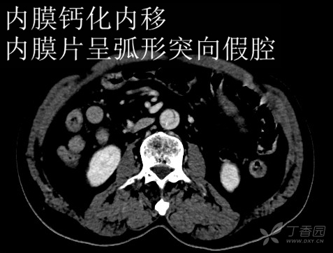 3305569842237102511-8w.jpg