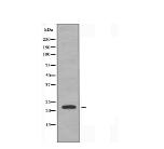 TNFC Antibody