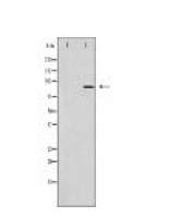 TLK2 Antibody