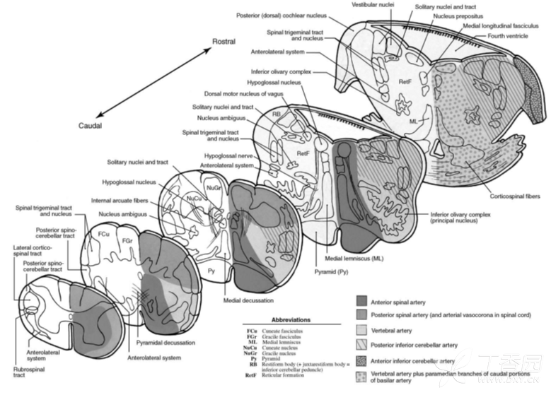 1:橋小腦束;2:腦橋核;3:皮質脊髓束;4:內側丘系;5:下橄欖核上部;6:面